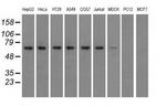IGF2BP2 Antibody in Western Blot (WB)