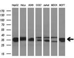 GNMT Monoclonal Antibody (OTI8A3)
