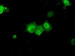 KHK Antibody in Immunocytochemistry (ICC/IF)