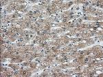 KHK Antibody in Immunohistochemistry (Paraffin) (IHC (P))