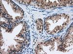 HID1 Antibody in Immunohistochemistry (Paraffin) (IHC (P))