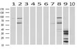 HID1 Antibody in Western Blot (WB)