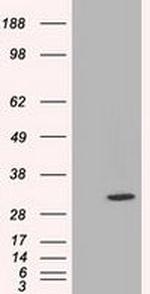 C21orf59 Antibody in Western Blot (WB)