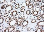 Thromboxane synthase Antibody in Immunohistochemistry (Paraffin) (IHC (P))