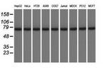 KBTBD7 Antibody in Western Blot (WB)