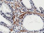 BTN1A1 Antibody in Immunohistochemistry (Paraffin) (IHC (P))