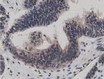 BTN1A1 Antibody in Immunohistochemistry (Paraffin) (IHC (P))