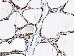 BTN1A1 Antibody in Immunohistochemistry (Paraffin) (IHC (P))