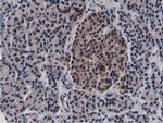 BTN1A1 Antibody in Immunohistochemistry (Paraffin) (IHC (P))