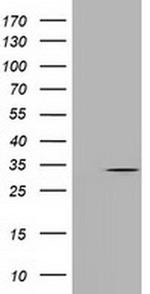 UCK1 Antibody in Western Blot (WB)