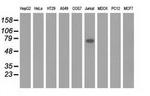 KLHL2 Antibody in Western Blot (WB)