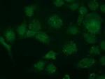 TRIM2 Antibody in Immunocytochemistry (ICC/IF)
