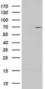 TRIM2 Antibody in Western Blot (WB)