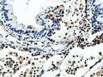 NT5D1 Antibody in Immunohistochemistry (Paraffin) (IHC (P))
