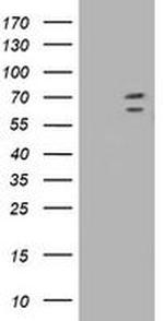 TRIM2 Antibody in Western Blot (WB)
