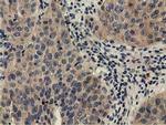 CBWD1 Antibody in Immunohistochemistry (Paraffin) (IHC (P))