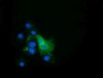EPHX2 Monoclonal Antibody (OTI1A6)
