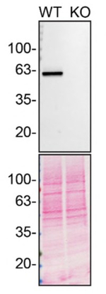 EPHX2 Antibody