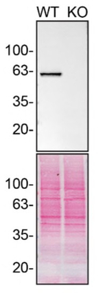EPHX2 Antibody