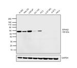 EPHX2 Antibody in Western Blot (WB)