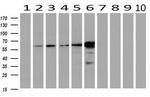 EPHX2 Antibody in Western Blot (WB)