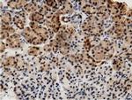 Adenylate Kinase 5 Antibody in Immunohistochemistry (Paraffin) (IHC (P))
