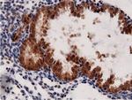 Adenylate Kinase 5 Antibody in Immunohistochemistry (Paraffin) (IHC (P))