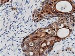 Adenylate Kinase 5 Antibody in Immunohistochemistry (Paraffin) (IHC (P))