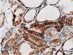 Adenylate Kinase 5 Antibody in Immunohistochemistry (Paraffin) (IHC (P))