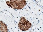 Adenylate Kinase 5 Antibody in Immunohistochemistry (Paraffin) (IHC (P))