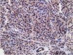 RBBP9 Antibody in Immunohistochemistry (Paraffin) (IHC (P))