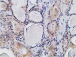 RBBP9 Antibody in Immunohistochemistry (Paraffin) (IHC (P))