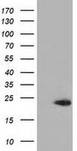 RBBP9 Antibody in Western Blot (WB)