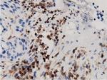 ARHGAP25 Antibody in Immunohistochemistry (Paraffin) (IHC (P))