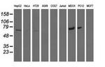 MTMR14 Antibody in Western Blot (WB)