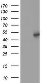 SLFNL1 Antibody in Western Blot (WB)