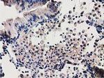 SSSCA1 Antibody in Immunohistochemistry (Paraffin) (IHC (P))