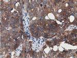 SSSCA1 Antibody in Immunohistochemistry (Paraffin) (IHC (P))