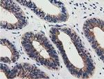 SSSCA1 Antibody in Immunohistochemistry (Paraffin) (IHC (P))