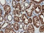 SSSCA1 Antibody in Immunohistochemistry (Paraffin) (IHC (P))