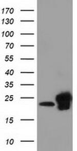 SSSCA1 Antibody in Western Blot (WB)