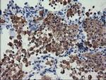 FAM84B Antibody in Immunohistochemistry (Paraffin) (IHC (P))