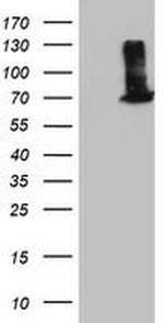 EPM2AIP1 Antibody in Western Blot (WB)
