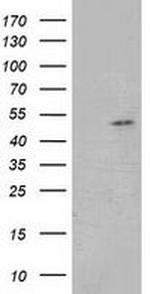 GSS Antibody in Western Blot (WB)