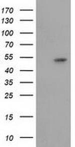 GSS Antibody in Western Blot (WB)