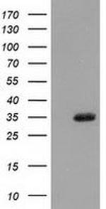 SULT1A1 Antibody in Western Blot (WB)