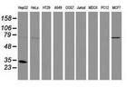 SULT1A1 Antibody in Western Blot (WB)
