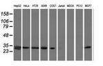 SPR Antibody in Western Blot (WB)