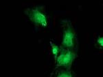 Bestrophin 3 Monoclonal Antibody (OTI2H3)