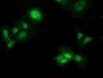 PBLD Monoclonal Antibody (OTI7G5)